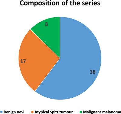 The Challenge of Melanocytic Lesions in Pediatric Patients: Clinical-Pathological Findings and the Diagnostic Value of PRAME